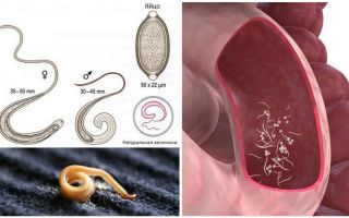 Hur man tar bort pinworms hos vuxna och barn