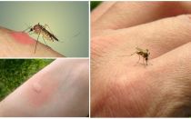 Varför myggor bita vissa människor mer än andra