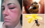 Vad händer om en bi slår i ögat och det sväller