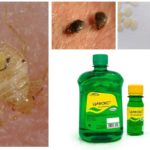 Cyclox botemedel mot bedbugs