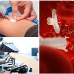 Blodtest för antikroppar mot Giardia